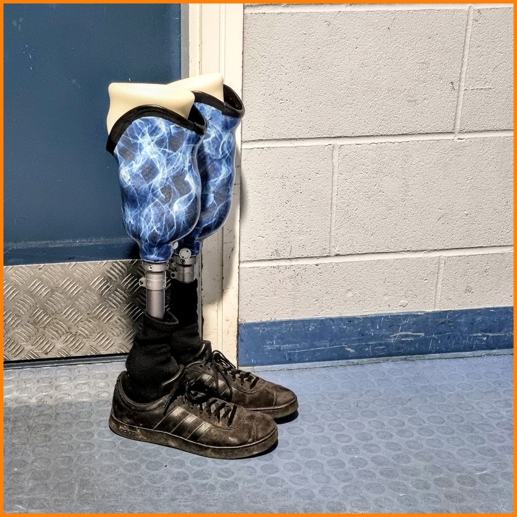 A player removes his prosthetics before getting on the ice.